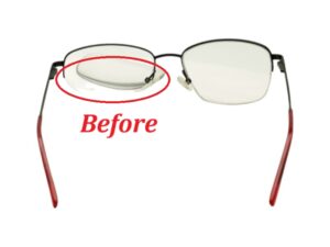 Half Metal Frame Before Left Nylon Filament Replacement